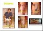 Diabetes4 1