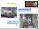Diabetes5